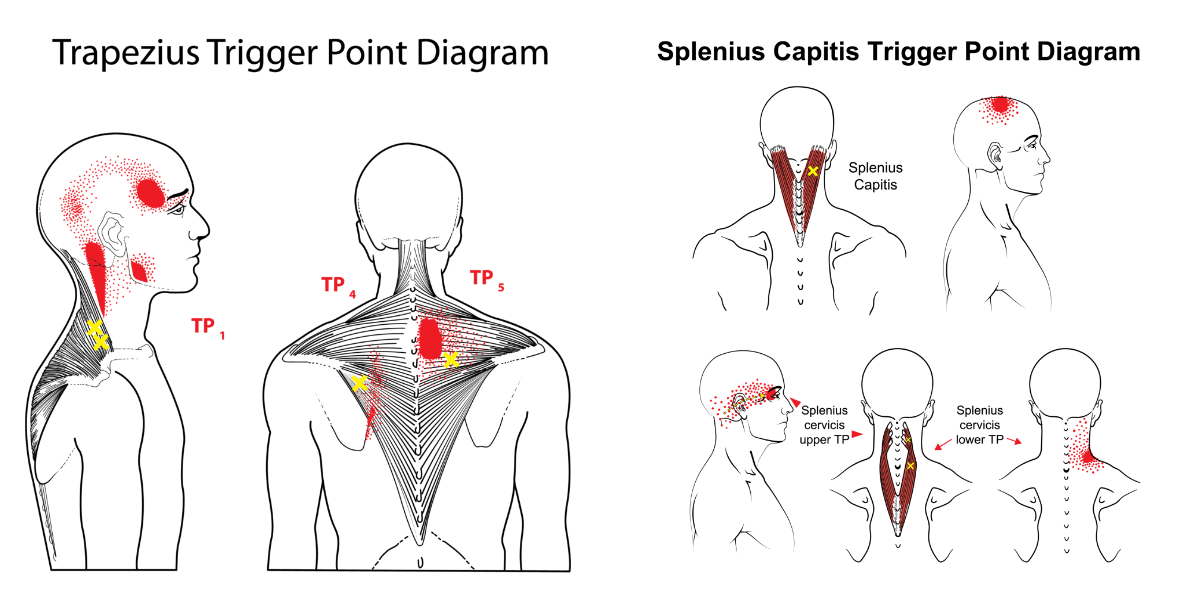鍼灸｜吉岡町のぞみ鍼灸整骨院